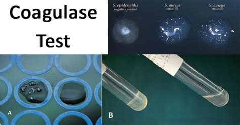 Coagulase Test: Principle, Procedure, Results • Microbe .